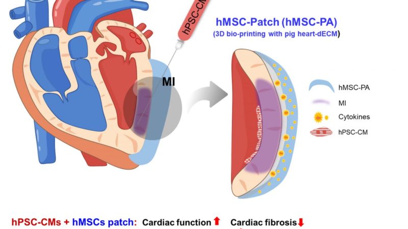 Stem Cell Treatment